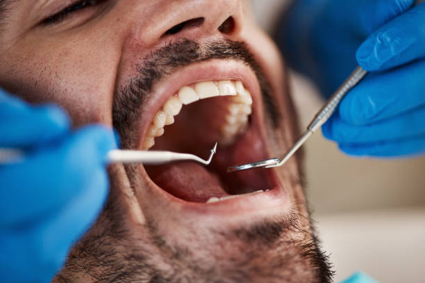 Best Emergency Dental Surgery in East Basin, UT